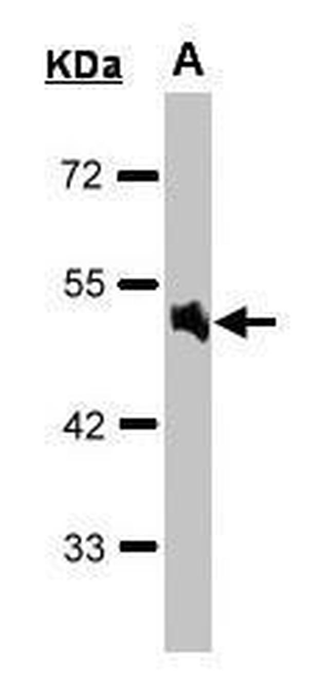 alpha-1a Adrenergic Receptor Antibody in Western Blot (WB)