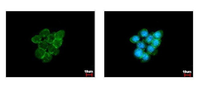 Caveolin 1 Antibody in Immunocytochemistry (ICC/IF)