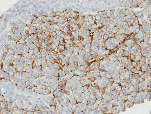 Caveolin 1 Antibody in Immunohistochemistry (Paraffin) (IHC (P))