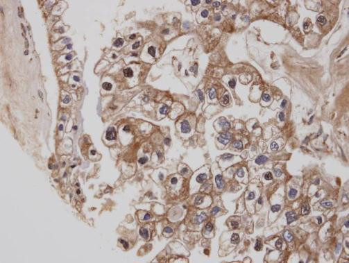 Cannabinoid Receptor 1 Antibody in Immunohistochemistry (Paraffin) (IHC (P))