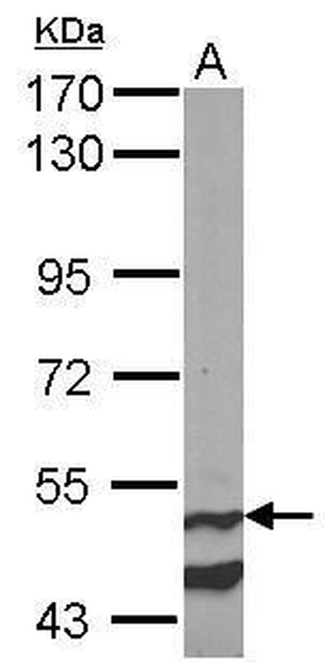 Cannabinoid Receptor 1 Antibody in Western Blot (WB)