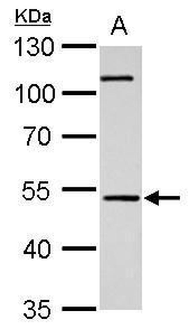 Cannabinoid Receptor 1 Antibody in Western Blot (WB)