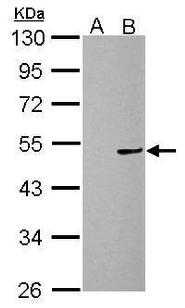 Cannabinoid Receptor 1 Antibody in Western Blot (WB)