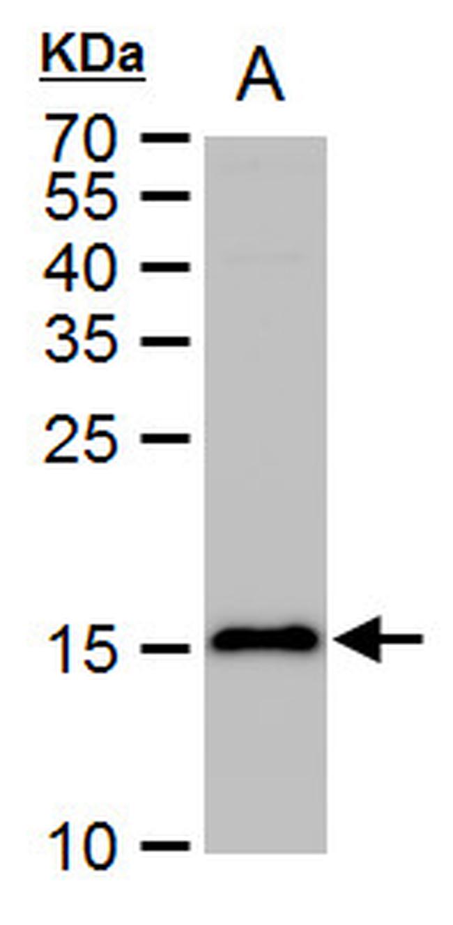 LC3B Antibody in Western Blot (WB)