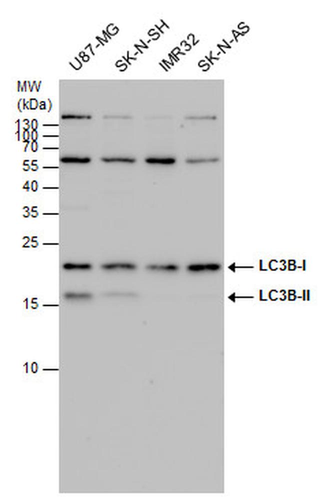 LC3B Antibody in Western Blot (WB)