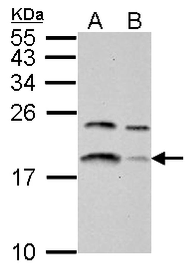 LC3B Antibody in Western Blot (WB)