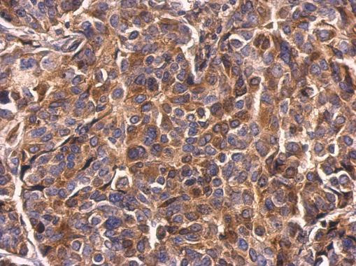 Survivin Antibody in Immunohistochemistry (Paraffin) (IHC (P))