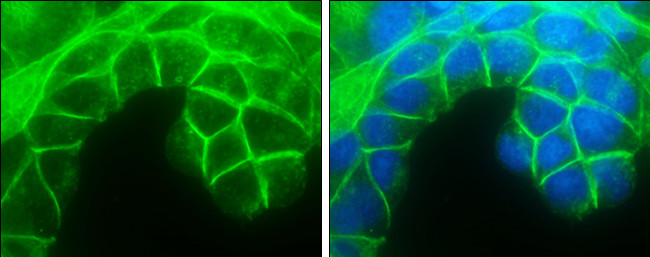 E-cadherin Antibody in Immunocytochemistry (ICC/IF)