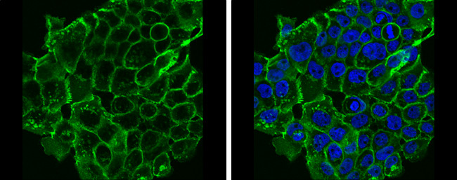 E-cadherin Antibody in Immunocytochemistry (ICC/IF)