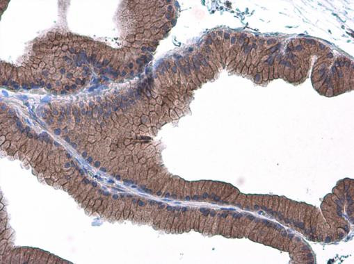 E-cadherin Antibody in Immunohistochemistry (Paraffin) (IHC (P))