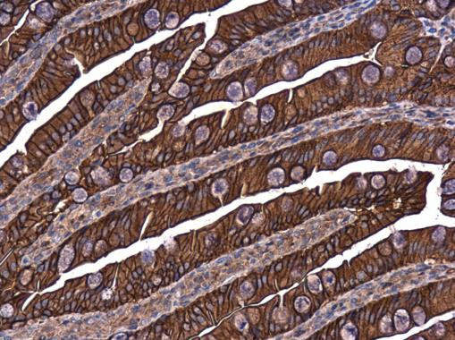 E-cadherin Antibody in Immunohistochemistry (Paraffin) (IHC (P))