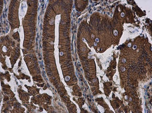 E-cadherin Antibody in Immunohistochemistry (Paraffin) (IHC (P))