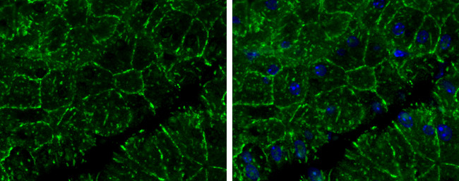 E-cadherin Antibody in Immunohistochemistry (Paraffin) (IHC (P))