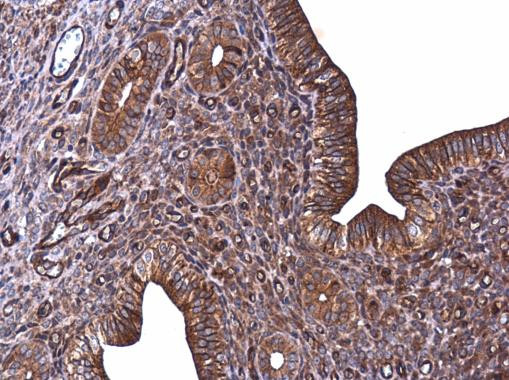 E-cadherin Antibody in Immunohistochemistry (Paraffin) (IHC (P))