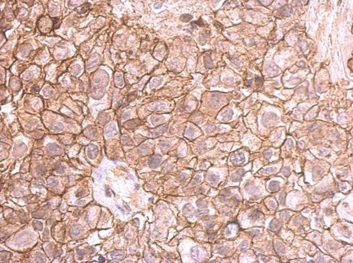 E-cadherin Antibody in Immunohistochemistry (Paraffin) (IHC (P))