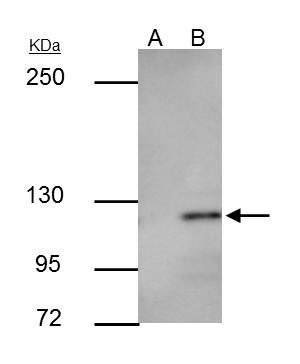 E-cadherin Antibody in Immunoprecipitation (IP)