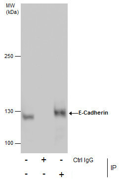 E-cadherin Antibody in Immunoprecipitation (IP)