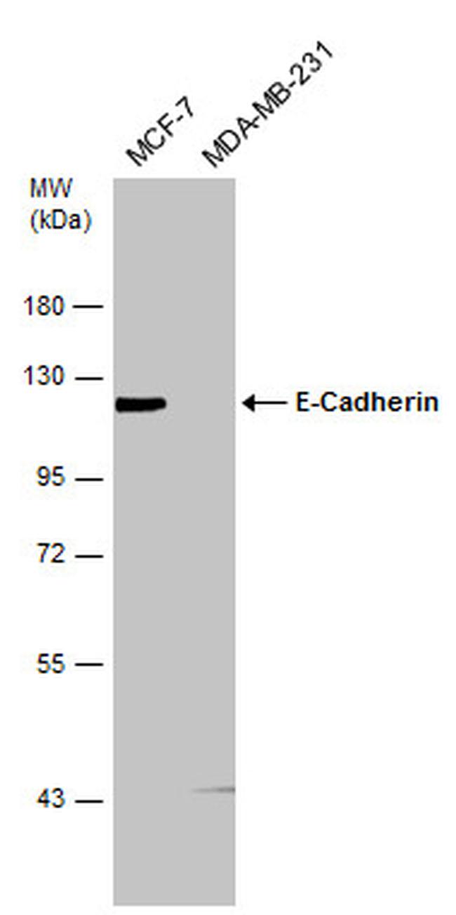 E-cadherin Antibody in Western Blot (WB)