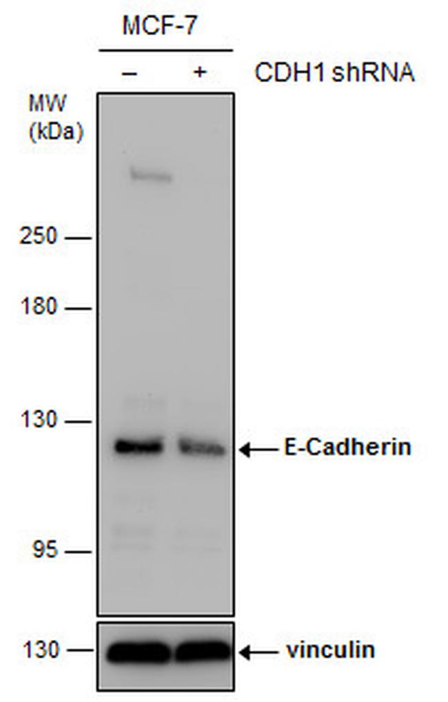 E-cadherin Antibody in Western Blot (WB)