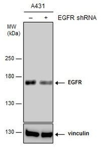 EGFR Antibody