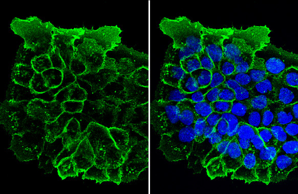 EGFR Antibody in Immunocytochemistry (ICC/IF)