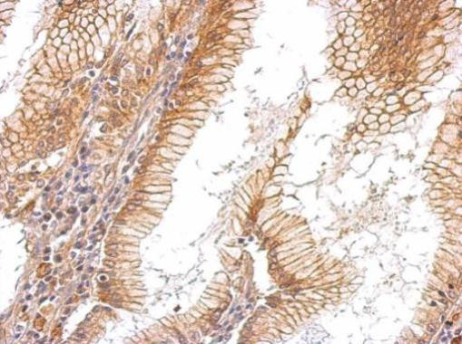 EGFR Antibody in Immunohistochemistry (Paraffin) (IHC (P))