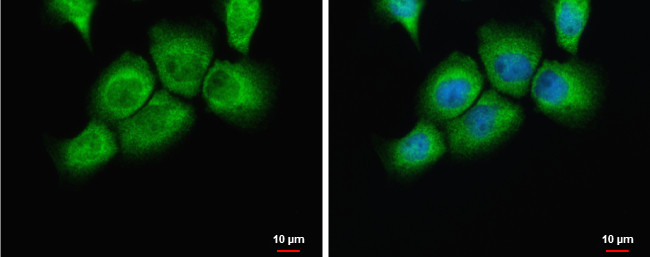 uPAR Antibody in Immunocytochemistry (ICC/IF)