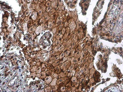 uPAR Antibody in Immunohistochemistry (Paraffin) (IHC (P))