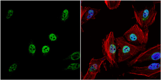 HDAC1 Antibody in Immunocytochemistry (ICC/IF)