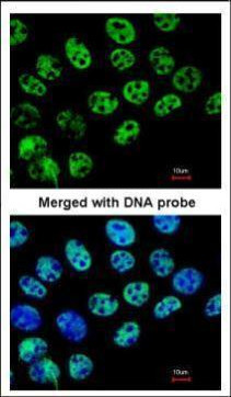 HDAC1 Antibody in Immunocytochemistry (ICC/IF)