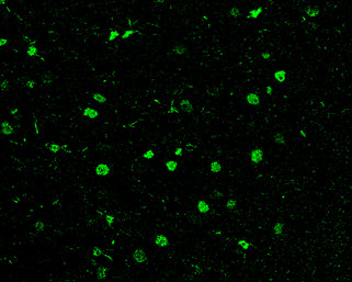 HDAC1 Antibody in Immunohistochemistry (Paraffin) (IHC (P))