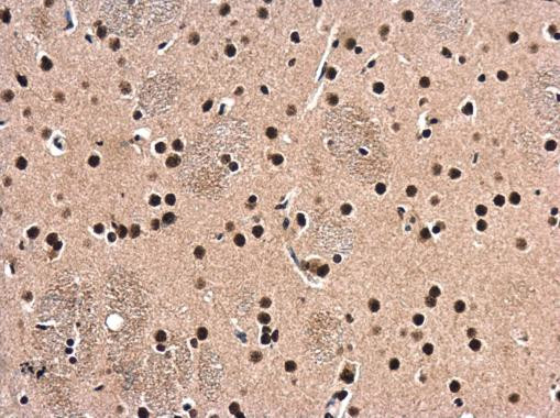 HDAC1 Antibody in Immunohistochemistry (Paraffin) (IHC (P))