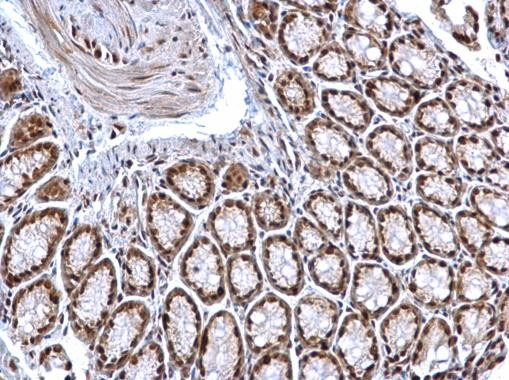 HDAC1 Antibody in Immunohistochemistry (Paraffin) (IHC (P))