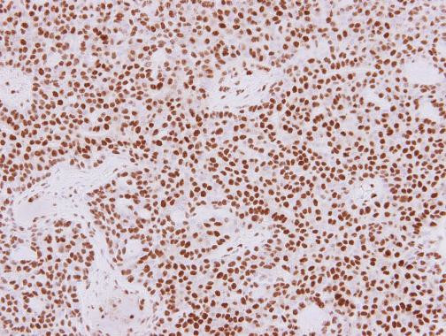 HDAC1 Antibody in Immunohistochemistry (Paraffin) (IHC (P))