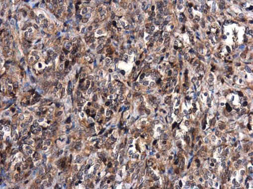 MDM2 Antibody in Immunohistochemistry (Paraffin) (IHC (P))