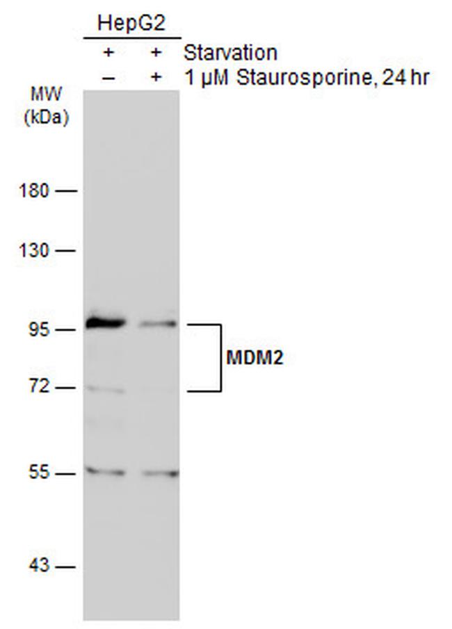 MDM2 Antibody in Western Blot (WB)