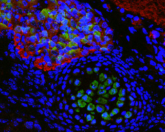 SOD1 Antibody in Immunohistochemistry (Paraffin) (IHC (P))