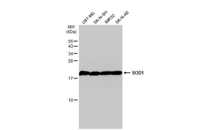 SOD1 Antibody in Western Blot (WB)