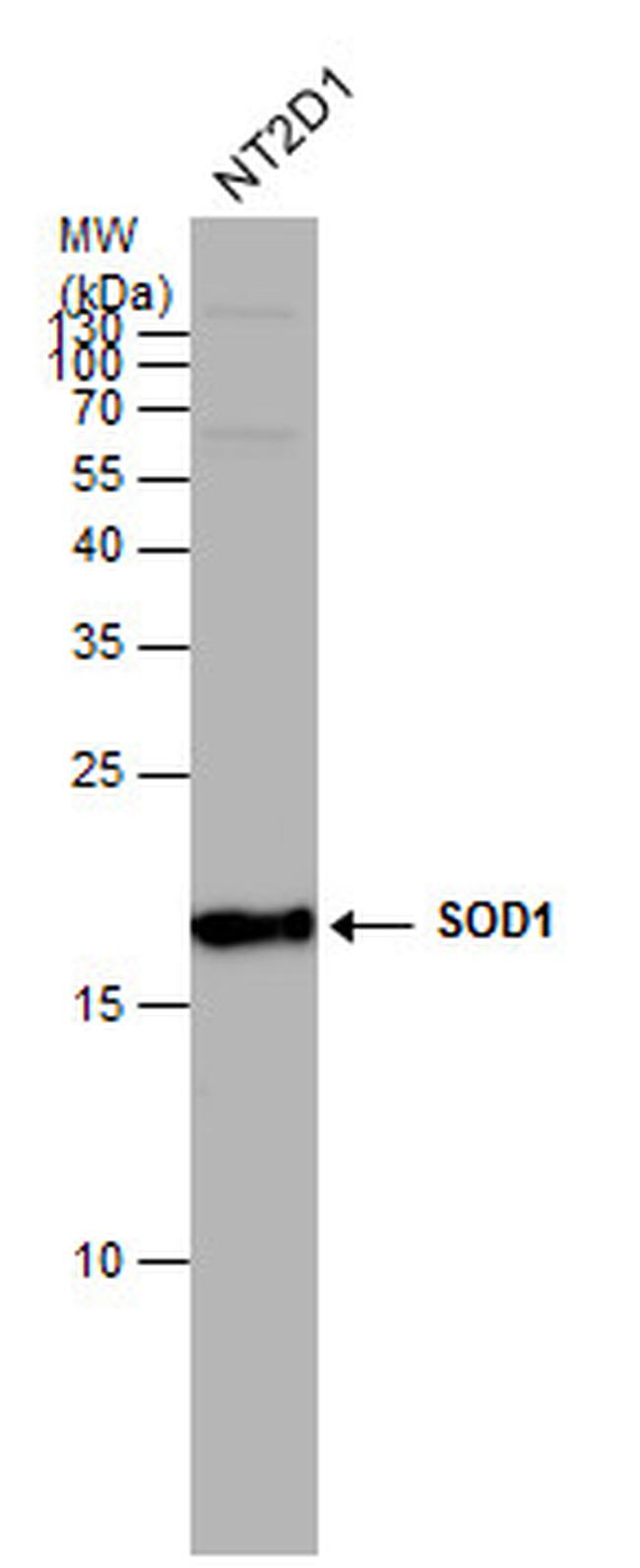 SOD1 Antibody in Western Blot (WB)