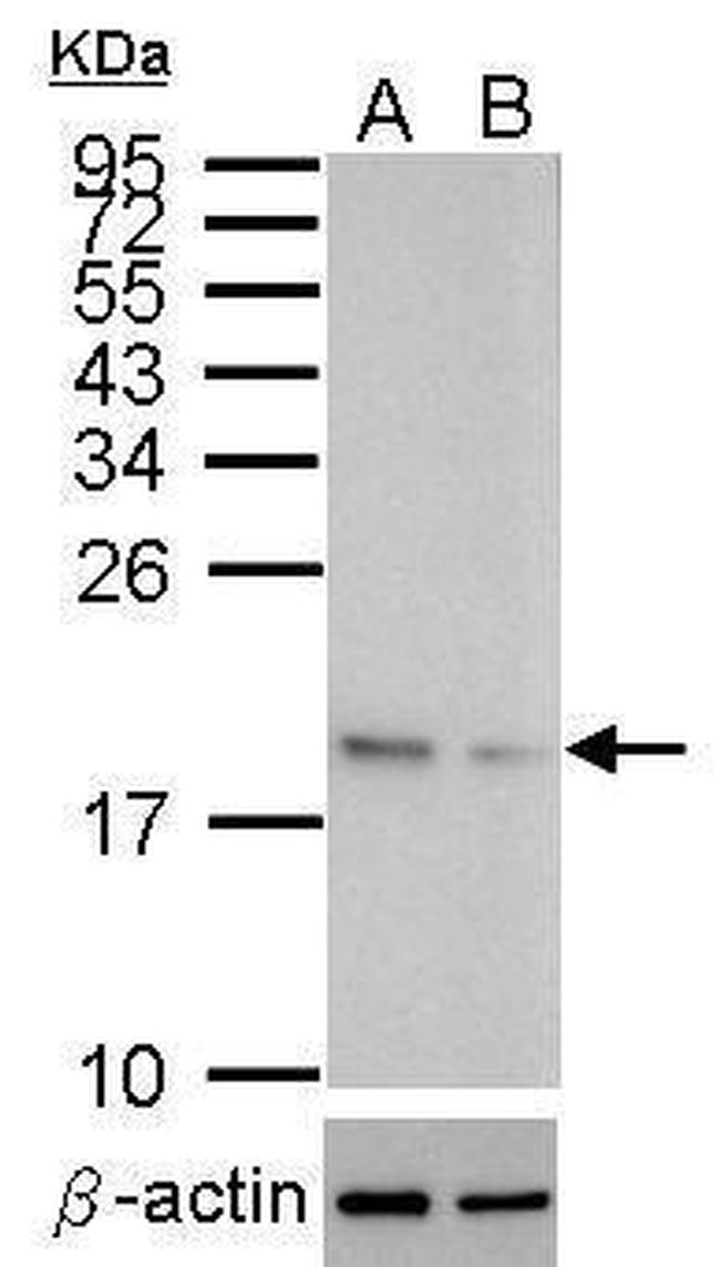 SOD1 Antibody in Western Blot (WB)