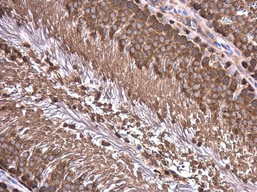 WT1 Antibody in Immunohistochemistry (Paraffin) (IHC (P))