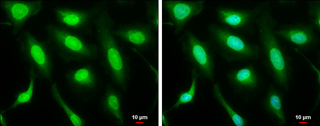 MDM2 Antibody in Immunocytochemistry (ICC/IF)