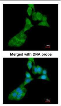 MMP3 Antibody in Immunocytochemistry (ICC/IF)