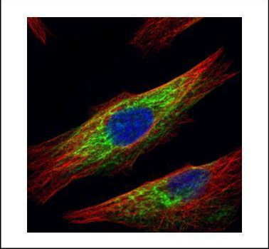 HDAC6 Antibody in Immunocytochemistry (ICC/IF)