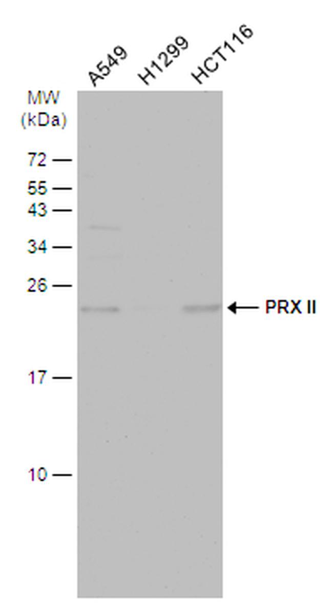 PRDX2 Antibody in Western Blot (WB)