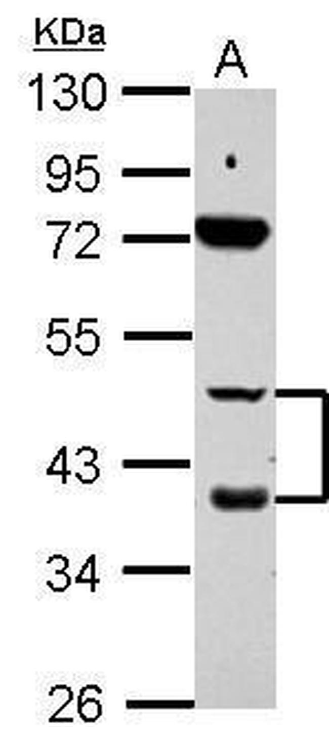 RARB Antibody in Western Blot (WB)