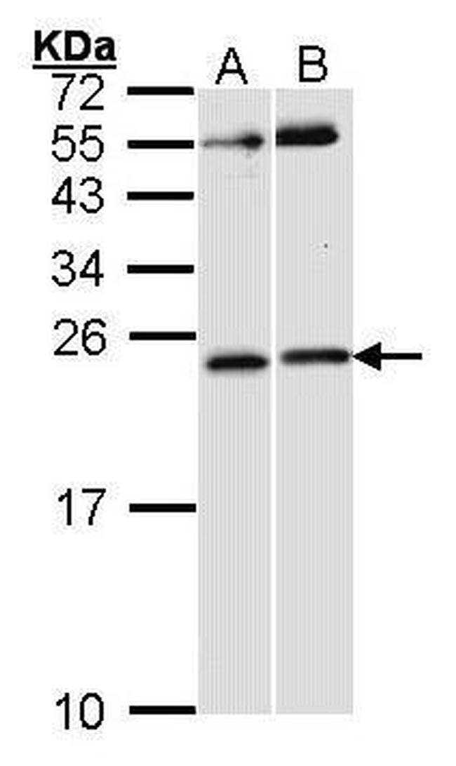 Phospho-RAC1/CDC42 (Ser71) Antibody in Western Blot (WB)