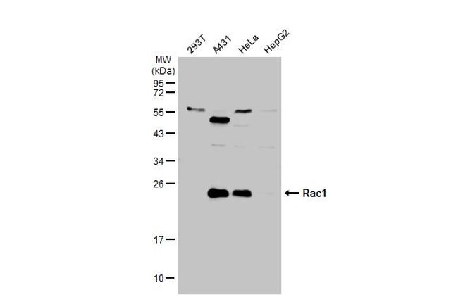 Phospho-RAC1/CDC42 (Ser71) Antibody in Western Blot (WB)