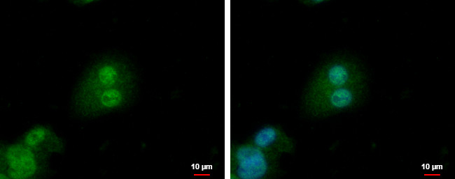 PTHLH Antibody in Immunocytochemistry (ICC/IF)