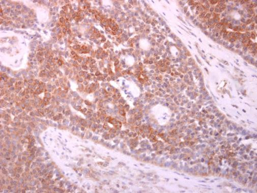 PTHLH Antibody in Immunohistochemistry (Paraffin) (IHC (P))